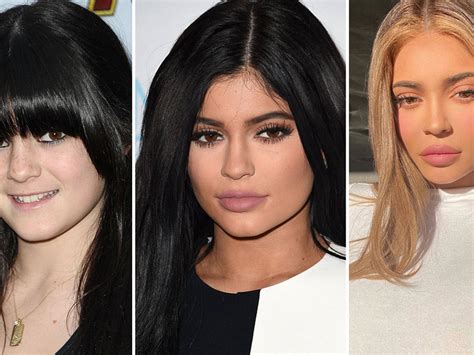 kylie vorher nachher|Kylie Jenner Before and After: From 2008 to 2022